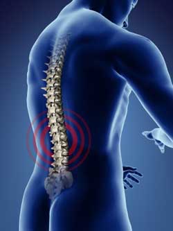 Scoliosis Treatment in Clifton, NJ